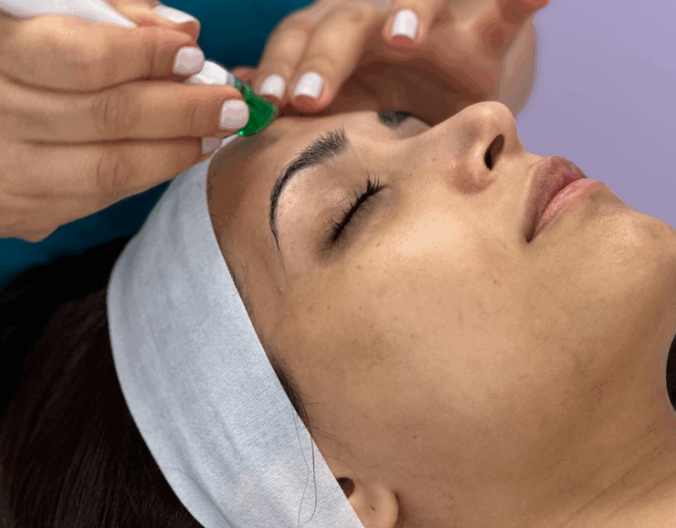 HydraFacial: Boost Your ICBC Recovery with Facial Rejuvenation