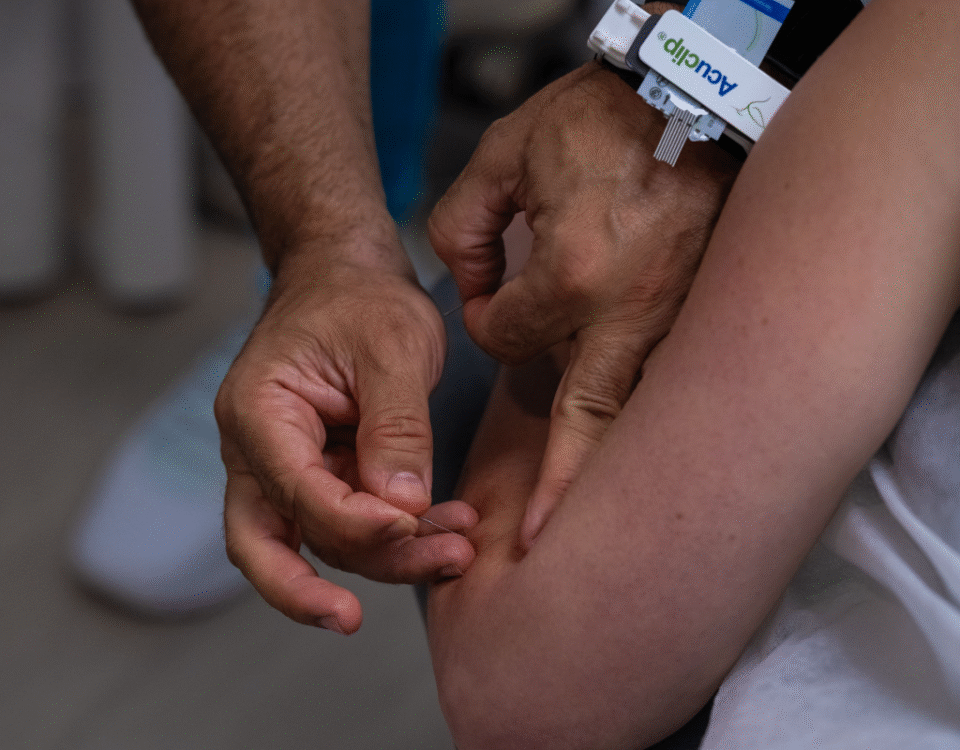 How Acupuncture Unveils Stress and Emotions in the Body