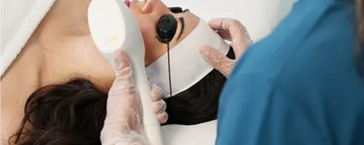 Discover RF Microneedling: Vancouver’s Skin Rejuvenation Solution