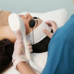 Discover RF Microneedling: Vancouver’s Skin Rejuvenation Solution
