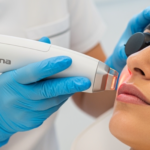 Fotona Laser Skin Tightening in Vancouver: A Modern Guide