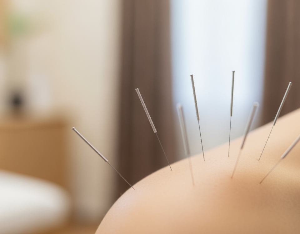 The Appointment She Kept Postponing: A Story About Acupuncture and the Cost of Waiting